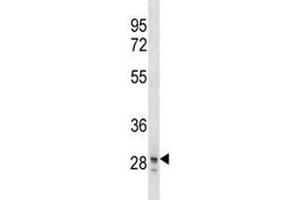 SNAI3 antibody western blot analysis in T47D lysate. (SNAI3 抗体  (AA 1-29))