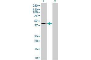 Western Blot analysis of FASN expression in transfected 293T cell line by FASN monoclonal antibody (M01A), clone 3F2-1F3. (Fatty Acid Synthase 抗体  (AA 1-439))