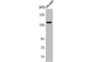 Western Blot analysis of COLO205 cells using A Cyclase V/VI Polyclonal Antibody (ADCY6 抗体  (C-Term))