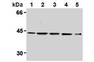 Western Blotting (WB) image for anti-Mitogen-Activated Protein Kinase Kinase 1 (MAP2K1) antibody (ABIN1108123) (MEK1 抗体)