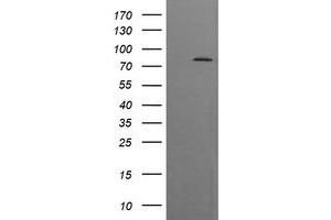 Image no. 1 for anti-Dynamin 1-Like (DNM1L) antibody (ABIN1497871) (Dynamin 1-Like 抗体)