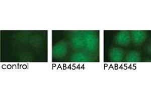 Indirect immunofluorescence analysis of GFP-PRKD3 fusion protein expression in Panc-1 cells by using PRKD3 polyclonal antibody  and PRKD3 polyclonal antibody  . (PRKD3 抗体  (C-Term))