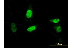 Immunofluorescence of monoclonal antibody to SURB7 on HepG2 cell. (MED21 抗体  (AA 1-144))