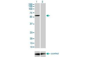 Western blot analysis of YES1 over-expressed 293 cell line, cotransfected with YES1 Validated Chimera RNAi (Lane 2) or non-transfected control (Lane 1). (YES1 抗体  (AA 1-543))