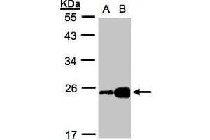 WB Image Sample(30 ug whole cell lysate) A:HeLa S3, B:Hep G2 , 12% SDS PAGE antibody diluted at 1:1000