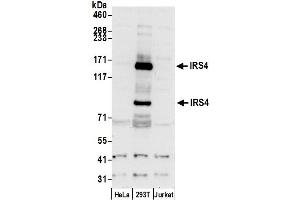 Western Blotting (WB) image for anti-Insulin Receptor Substrate 4 (IRS4) (AA 1207-1257) antibody (ABIN7450373)