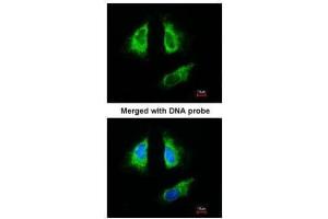 ICC/IF Image Immunofluorescence analysis of paraformaldehyde-fixed HeLa, using 14-3-3 beta , antibody at 1:200 dilution. (YWHAB 抗体  (Center))