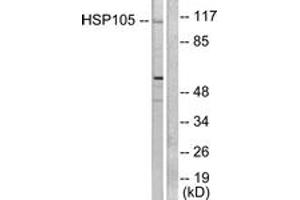 Western blot analysis of extracts from HeLa cells, using HSP105 Antibody. (HSPH1 抗体  (AA 791-840))