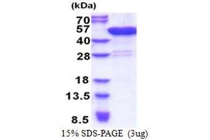 Coiled-Coil Domain Containing 104 (CCDC104) (AA 1-342) protein (His tag)
