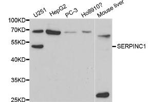 Western blot analysis of extracts of various cell lines, using SERPINC1 antibody. (SERPINC1 抗体)