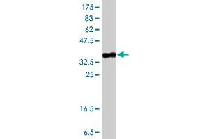 Western Blot detection against Immunogen (37 KDa) . (LCAT 抗体  (AA 98-197))