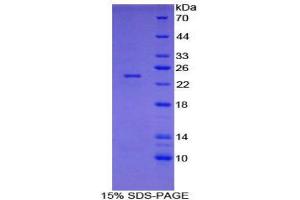 SDS-PAGE (SDS) image for Spondin 1 (SPON1) (AA 608-802) protein (His tag) (ABIN2122130) (SPON1 Protein (AA 608-802) (His tag))