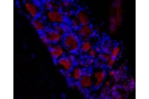 Expression of HCN3 in rat dorsal root ganglia (DRG) - Immunohistochemical staining of frozen section of rat DRG using Anti-HCN3 Antibody (ABIN7043281, ABIN7044972 and ABIN7044973), (1:50) followed by mouse anti-rabbit Alexa Fluor 555 (red). (HCN3 抗体  (Intracellular))
