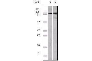 Western blot analysis using EphA1 mouse mAb against A549 (1) and Hela (2) cell lysate. (EPHA1 抗体)