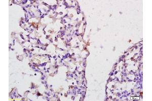 Formalin-fixed and paraffin embedded rat lung labeled with Anti-IL-22BP Polyclonal Antibody, Unconjugated (ABIN748193) at 1:200 followed by conjugation to the secondary antibody and DAB staining. (IL22RA2 抗体  (AA 165-263))