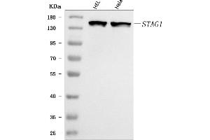 Western blot analysis of SA1/STAG1 using anti-SA1/STAG1 antibody (ABIN7602412).