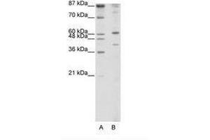 Image no. 1 for anti-REX4, RNA Exonuclease 4 Homolog (REXO4) (N-Term) antibody (ABIN202487) (REXO4 抗体  (N-Term))