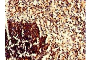Immunohistochemistry of paraffin-embedded human spleen tissue using ABIN7145141 at dilution of 1:100 (CD79a 抗体  (AA 70-142))