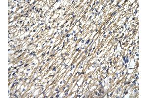 Rabbit Anti-STAT4 antibody Catalog Number: ARP33376  Paraffin Embedded Tissue: Human Heart cell Cellular Data: cardiac cell of renal tubule Antibody Concentration: 4. (STAT4 抗体  (N-Term))