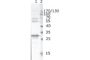 Western Blot testing of HIV-1 recombinant Nef protein. (HIV-1 Nef (AA 62-68) 抗体)