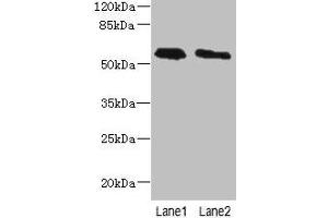 Western blot All lanes: PLD4 antibody at 4 μg/mL Lane 1: THP-1 whole cell lysate Lane 2: Human placenta tissue Secondary Goat polyclonal to rabbit IgG at 1/10000 dilution Predicted band size: 56 kDa Observed band size: 56 kDa (Phospholipase D4 抗体  (AA 52-506))