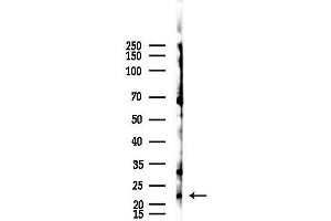 Western blot analysis of lysates from F10-LUC cells(starvation,24h treatment), using CBF beta Antibody at 1/1000 dilution.