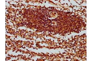 IHC image of ABIN7169487 diluted at 1:400 and staining in paraffin-embedded human spleen tissue performed on a Leica BondTM system. (SH3BP1 抗体  (AA 161-266))