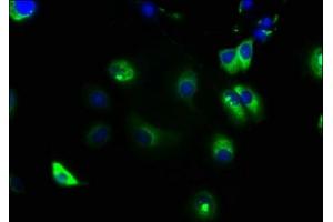 Immunofluorescence staining of MCF-7 cells with ABIN7161298 at 1:133, counter-stained with DAPI. (NOTCH2 抗体  (AA 59-250))