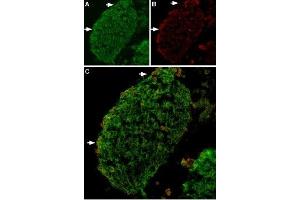 Immunohistochemistry (IHC) image for anti-Transient Receptor Potential Cation Channel, Subfamily V, Member 2 (TRPV2) (AA 735-750), (Intracellular) antibody (ABIN7043842)