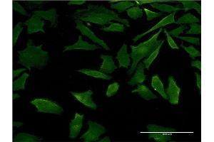 Immunofluorescence of monoclonal antibody to DFNB31 on HeLa cell. (DFNB31 抗体  (AA 808-907))