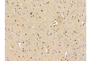 ASPA Antibody at 1/100 staining rat brain tissue by IHC-P. (ASPA 抗体  (Internal Region))