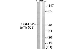Western blot analysis of extracts from HT-29 cells, treated with heat shock, using CRMP2 (Phospho-Thr509) antibody.