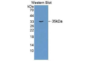 Western blot analysis of the recombinant protein. (UMPS 抗体  (AA 205-480))