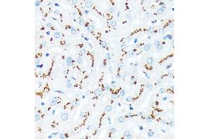 Immunohistochemistry of paraffin-embedded human liver using TGN46/TGOLN2 Rabbit mAb (ABIN7270875) at dilution of 1:100 (40x lens). (TGOLN2 抗体)