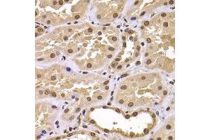 Immunohistochemistry of paraffin-embedded human kidney using CSRP2BP antibody at dilution of 1:100 (x400 lens). (CSRP2BP 抗体)