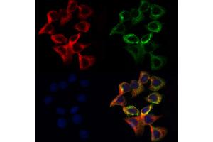 ABIN7094062 and ABIN7098106 staining Hela cells by IF/ICC. (ALDH5A1 抗体  (Internal Region))