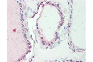 Anti-SP2 antibody IHC staining of human thyroid. (Sp2 抗体  (AA 180-229))