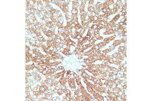 Immunohistochemistry of paraffin-embedded human colon carcinoma using SLC39 antibody (ABIN1682781, ABIN3017803, ABIN3017805 and ABIN6220263) at dilution of 1:100 (40x lens). (SLC39A4 抗体  (AA 23-327))