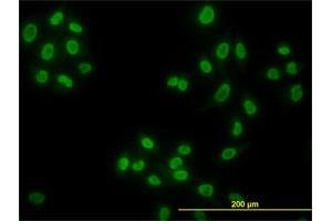 Immunofluorescence of monoclonal antibody to HDAC1 on HeLa cell. (HDAC1 抗体  (AA 1-482))