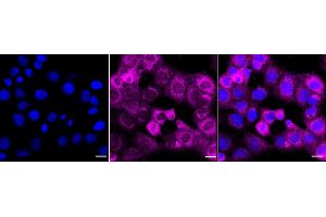 Immunocytochemical staining of HT- cells with NQO1 antibody (ABIN7800954), 1:1,000). (Recombinant NADH Quinone Dehydrogenase 1 抗体)