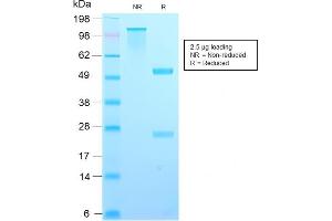 SDS-PAGE Analysis Purified TIMP2 Rabbit Recombinant Monoclonal Antibody (TIMP2/2488R). (Recombinant TIMP2 抗体  (N-Term))