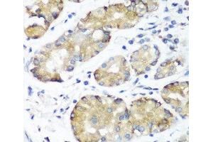 Immunohistochemistry of paraffin-embedded Human stomach using NOTCH2 Polyclonal Antibody at dilution of 1:100 (40x lens). (NOTCH2 抗体)