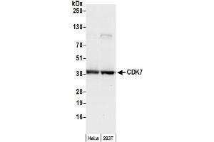 Western Blotting (WB) image for anti-Cyclin-Dependent Kinase 7 (CDK7) (C-Term) antibody (ABIN7455080)