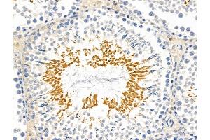 ABIN6261998 and ABIN6269009 at 1/100 staining Rat testis tissue by IHC-P.