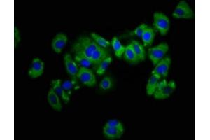 Immunofluorescence (IF) image for anti-Killer Cell Immunoglobulin-Like Receptor, Two Domains, Long Cytoplasmic Tail, 1 (KIR2DL1) (AA 162-267) antibody (ABIN7157495)