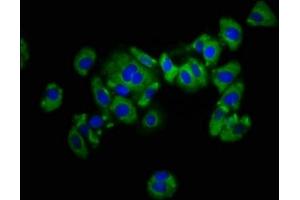 Immunofluorescence staining of HepG2 cells with ABIN7157495 at 1:133, counter-stained with DAPI. (KIR2DL1 抗体  (AA 162-267))