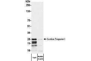 Western Blotting (WB) image for anti-Cardiac Troponin I (TNNI3) antibody (ABIN7795611)