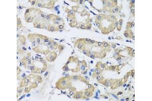 Immunohistochemistry of paraffin-embedded Human stomach using SCG3 Polyclonal Antibody at dilution of 1:100 (40x lens). (SCG3 抗体)
