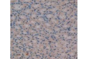 Immunohistochemistry (IHC) image for anti-High Mobility Group AT-Hook 1 (HMGA1) (AA 1-107) antibody (ABIN1078144)