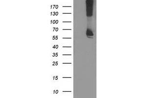 Western Blotting (WB) image for anti-Ribophorin 1 (RPN1) antibody (ABIN1500748) (RPN1 抗体)